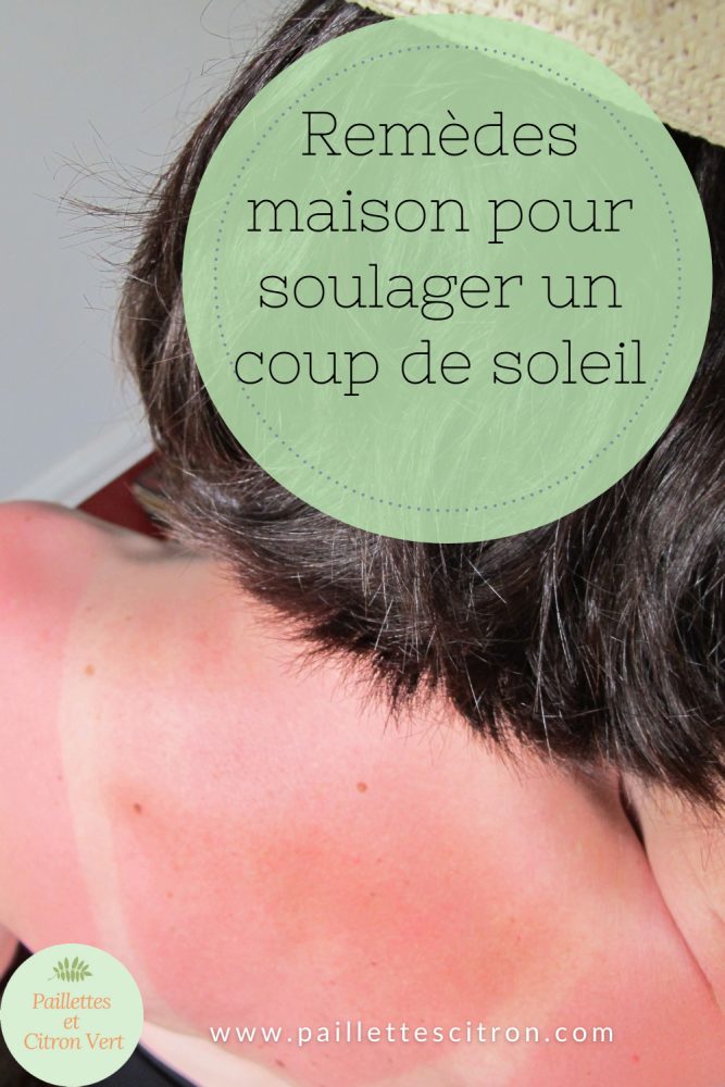 Remèdes maison pour soulager un coup de soleil